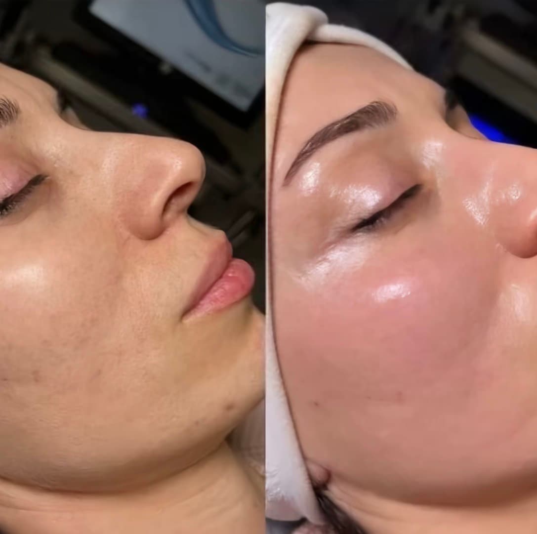 تنظيف البشرة الطبي